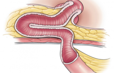 Образовательный центр WETLAB | Фото из: Atlas of Intestinal Stomas. Автор: Victor W. Fazio.