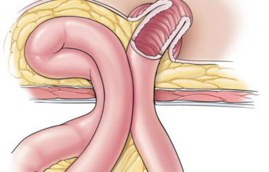 Образовательный центр WETLAB | Фото из: Atlas of Intestinal Stomas. Автор: Victor W. Fazio.