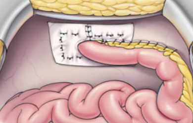 Образовательный центр WETLAB | Фото из: Atlas of Intestinal Stomas. Автор: Victor W. Fazio.