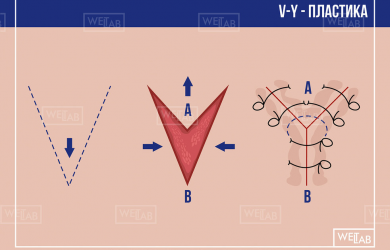 Образовательный центр WETLAB | Базовый модуль по пластической хирургии