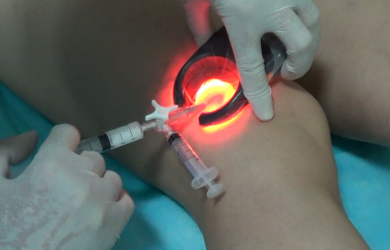 Образовательный центр WETLAB | Modern methods of treatment of varicose veins.