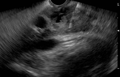 Образовательный центр WETLAB | Endosonographic image using a convection sensor