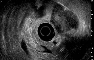 Образовательный центр WETLAB | Endosonographic image using a radial sensor